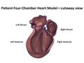 Patient Four-Chamber Heart Model   cutaway view