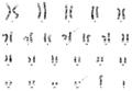 karyotype t(9;22)