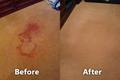 Before and after photo of carpet stain cleaning/removal
